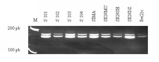 Figura 3 - Delecin homocigtica de p14/ARF en lneas celulares de neuroblatoma.
Gel de acrilamida (19:1) al 15% teido con bromuro de etidio (0,2 μg/ml). Se utilizaron cuatro DNAs extraidos de sangre perifrica de donantes sanos como control negativo. El marcador de peso molecular empleado (M) fue 1Kb Plus Ladder, Invitrogen.
